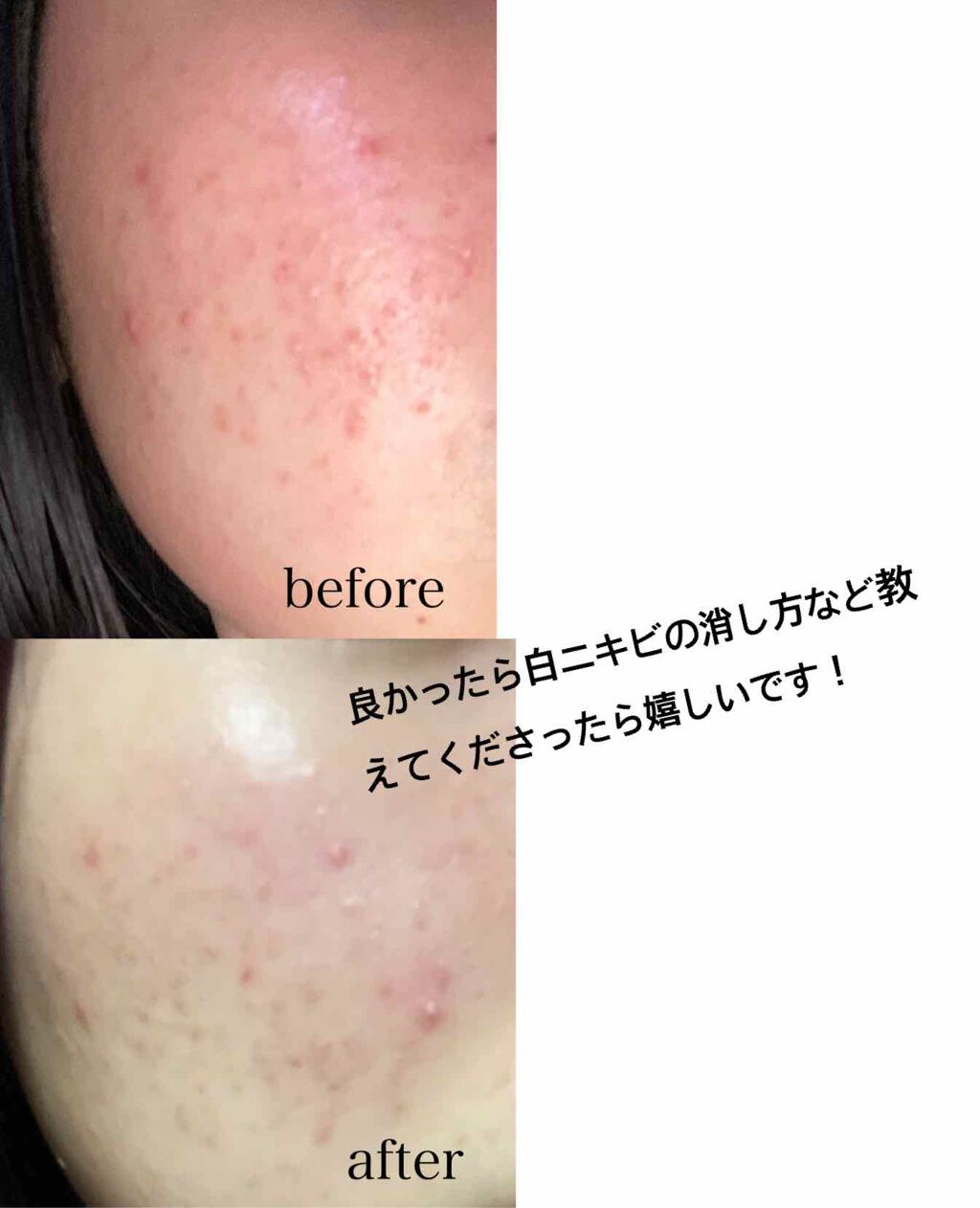 スクワビューティ 素肌いきいき美容液マスク/スクワビューティー/シートマスク・パックを使ったクチコミ(3枚目)