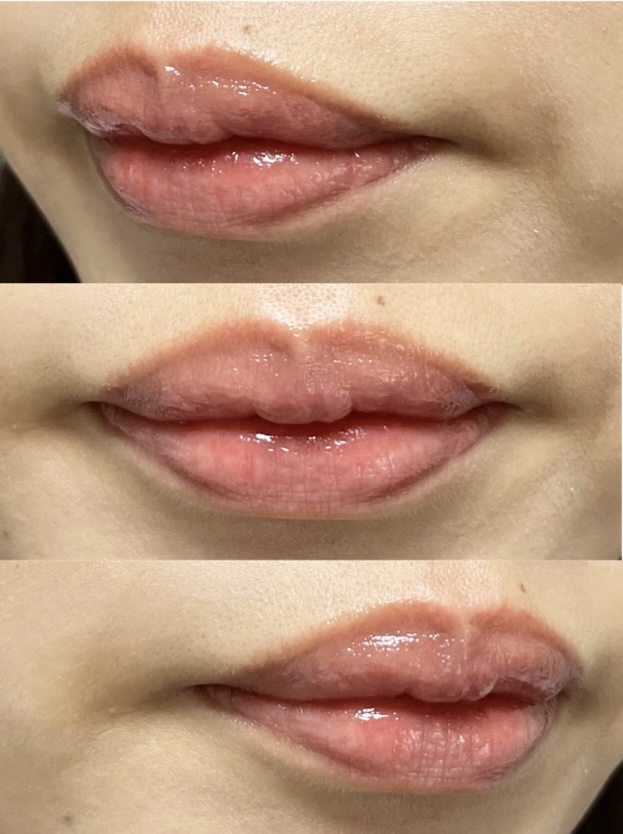 フルーティーグラムティント/Laka/リップティントを使ったクチコミ（2枚目）