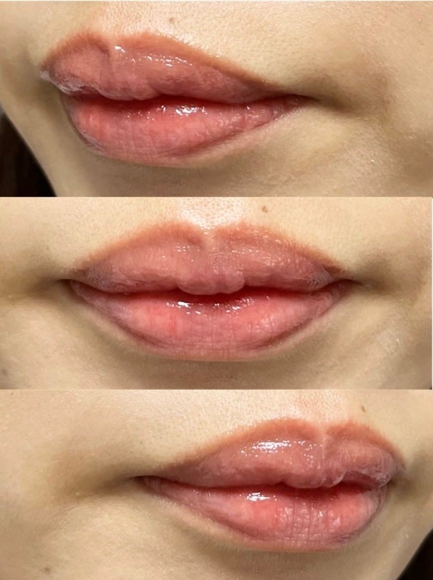 フルーティーグラムティント/Laka/リップティントを使ったクチコミ(2枚目)