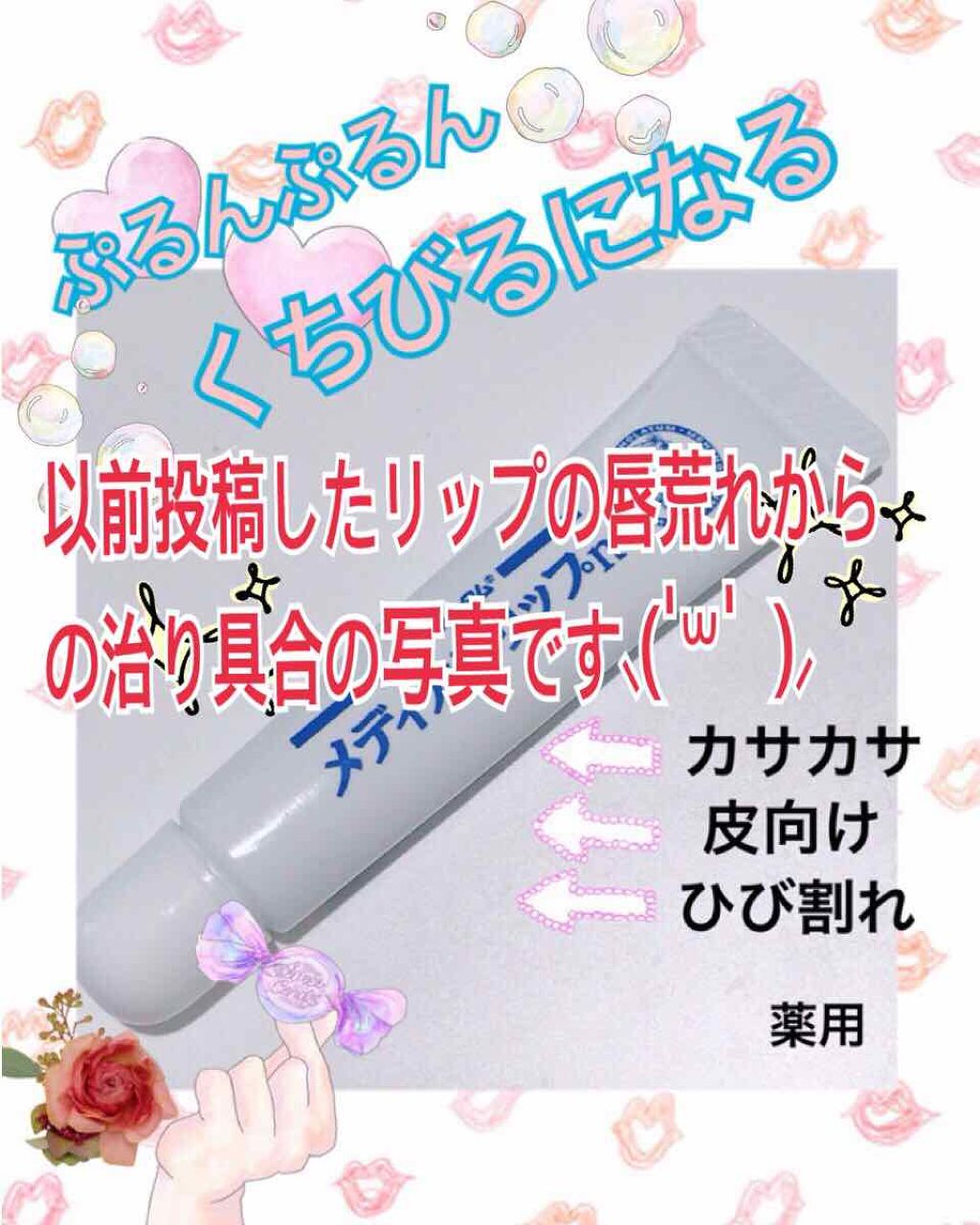 リップティントシロップ/キャンメイク/リップティントを使ったクチコミ(1枚目)