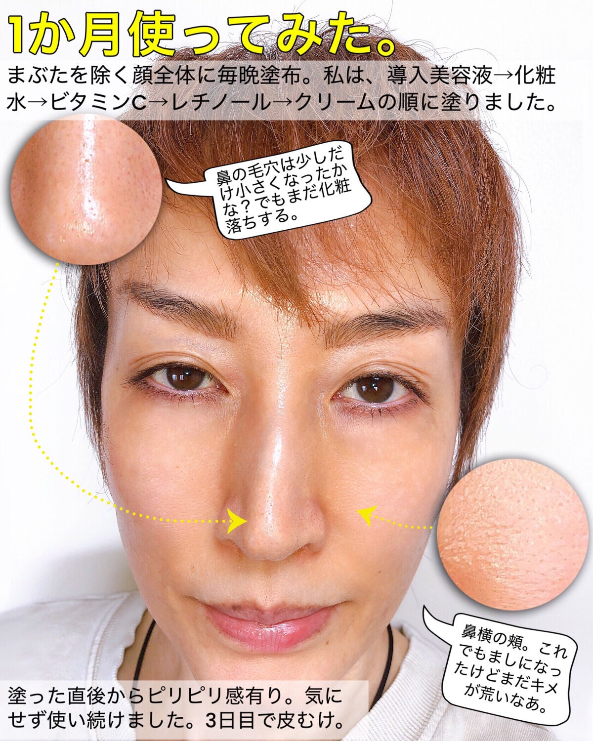 DS RTN リニューイング セラム/Kiehl's/美容液を使ったクチコミ(7枚目)