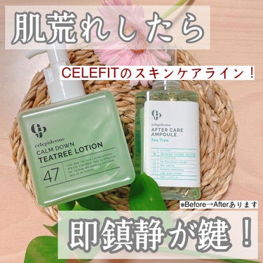 AFTERCARE AMPOULE TEA TREE/celepiderme/美容液を使ったクチコミ（1枚目）