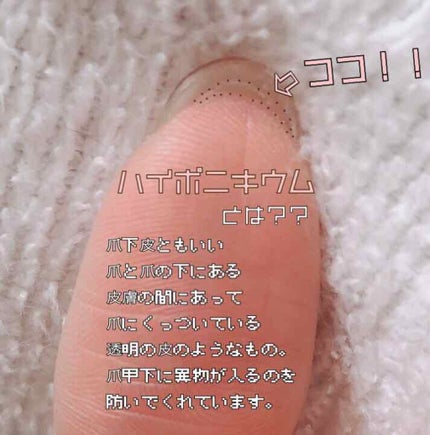 ディープセラム/Dr.Nail/ネイルオイル・トリートメントを使ったクチコミ(4枚目)