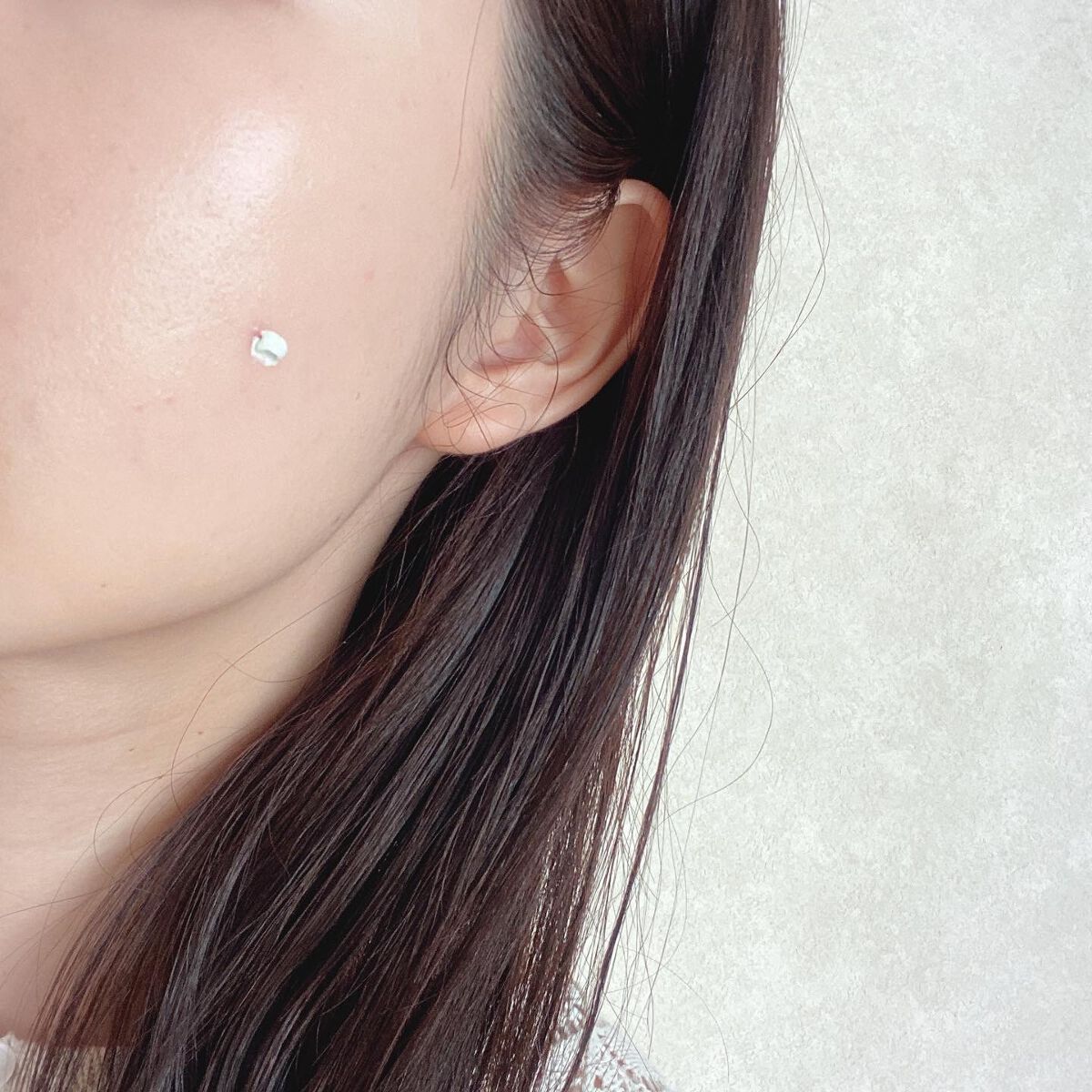 ミラクルアクネクリアスポットトリートメント/SOME BY MI/美容液を使ったクチコミ(5枚目)