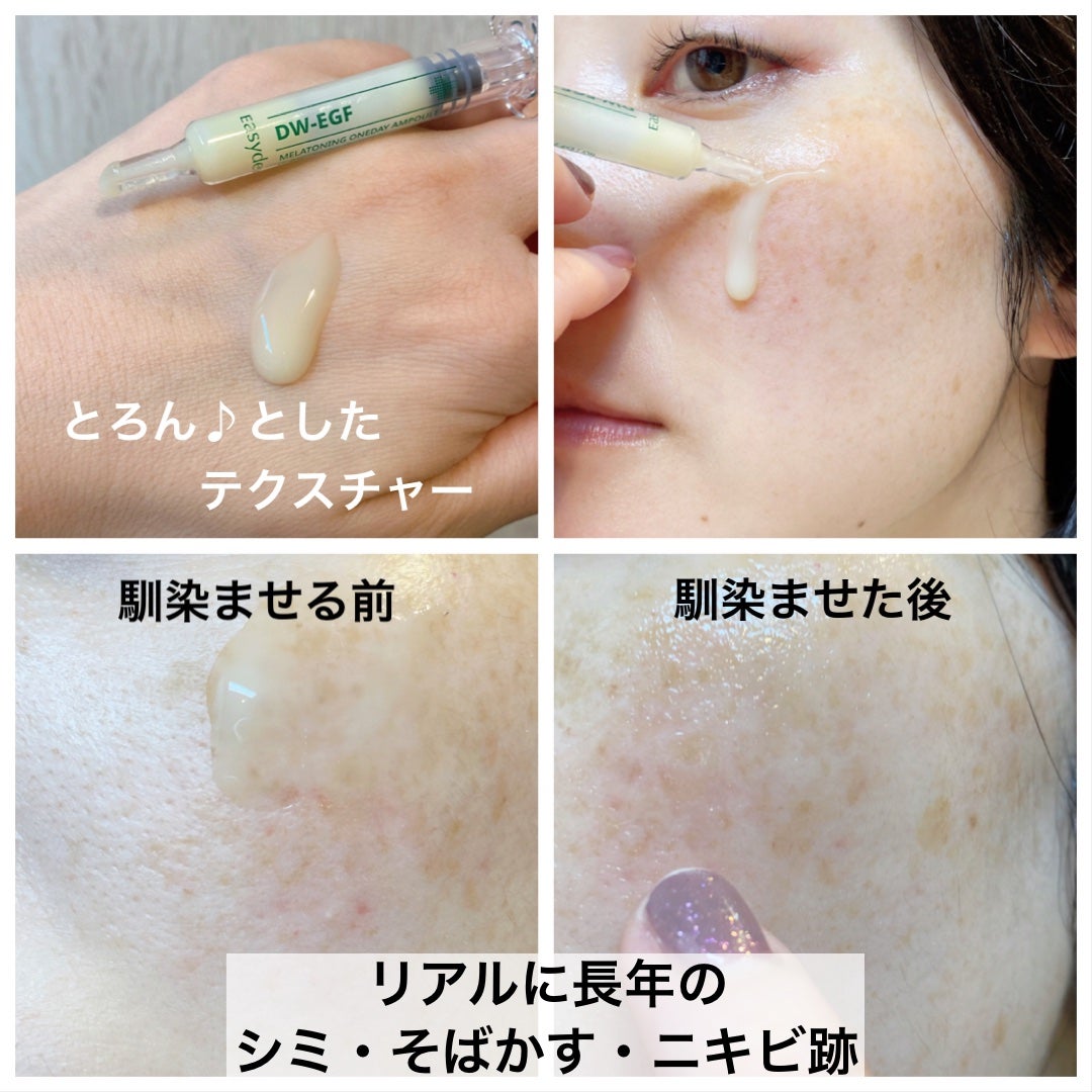 DW-EGFワンデイズアンプル/Easydew/美容液を使ったクチコミ(3枚目)