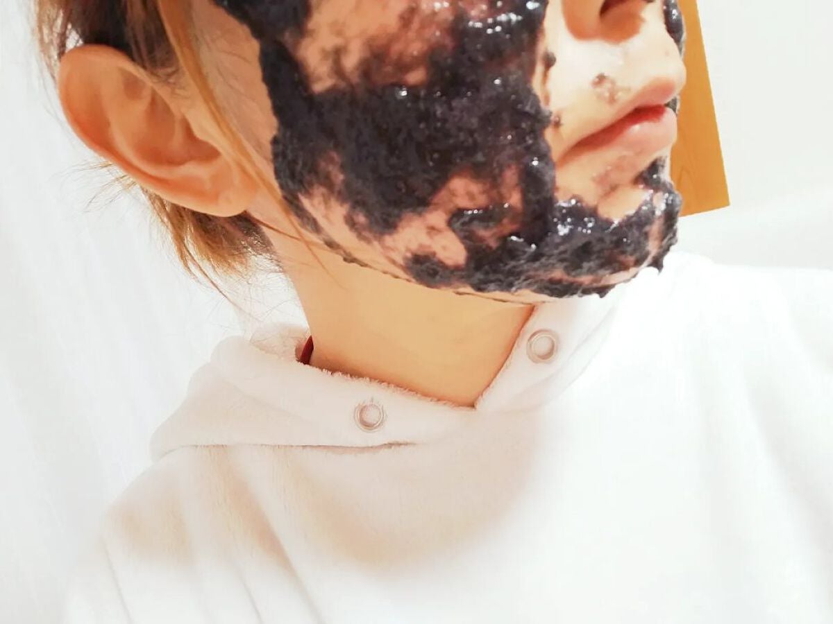 ニードル炭酸パック/NNE/洗い流すパック・マスクを使ったクチコミ(6枚目)