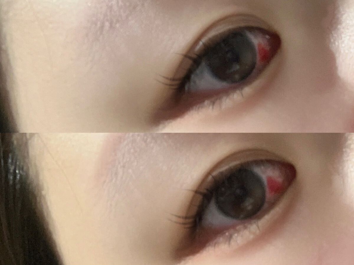 エーオーセプト クリアケア/エーオーセプト　クリアケア/その他を使ったクチコミ（3枚目）