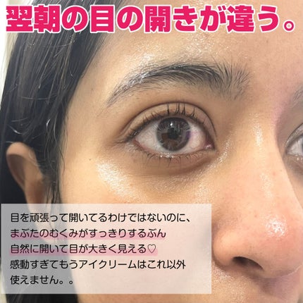 グラン アイ セラム V/CLARINS/アイケア・アイクリームを使ったクチコミ(6枚目)