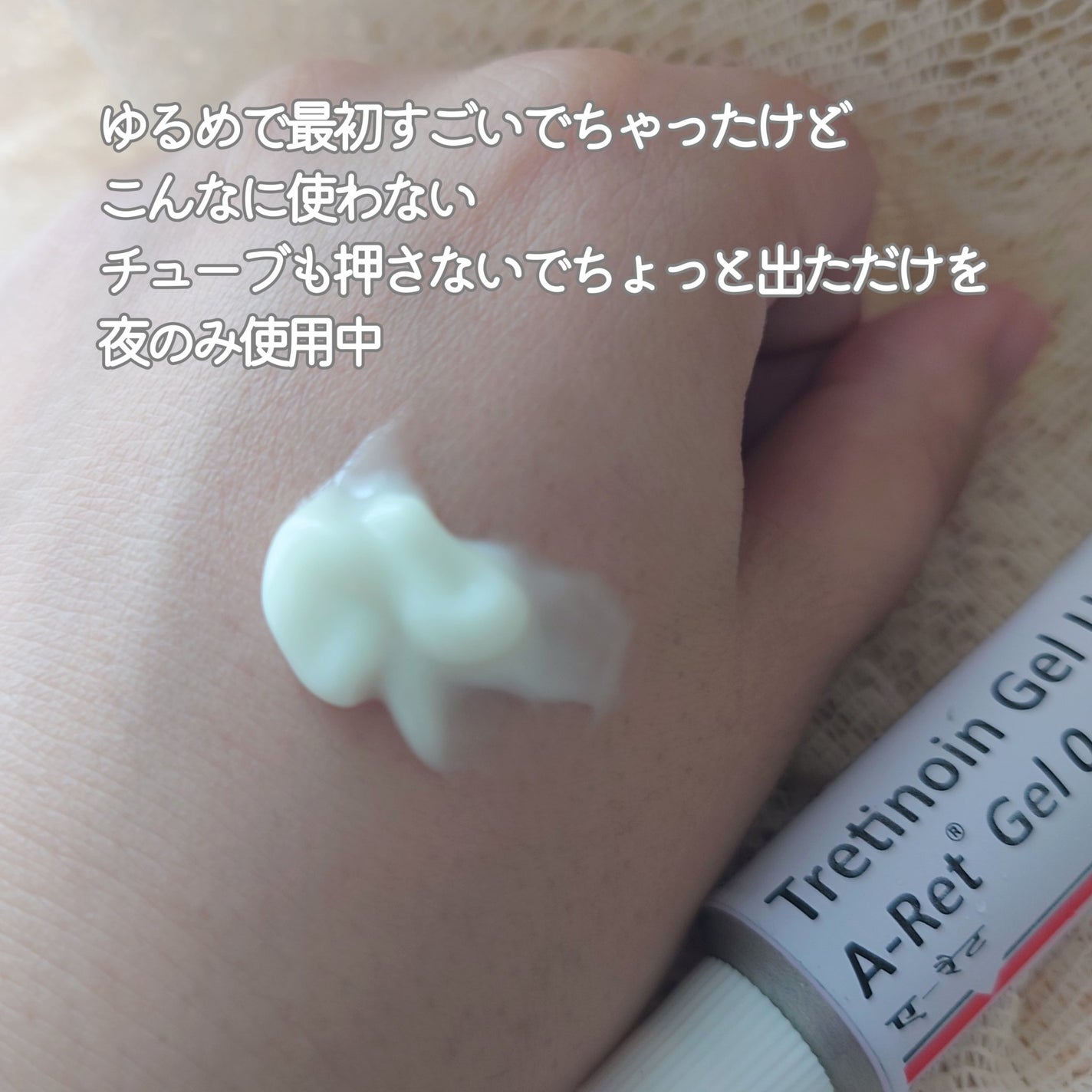 トレチノインジェル/A-Ret/美容液を使ったクチコミ(2枚目)