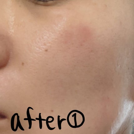 ハイドロクリームPHQ-8/KISO/美容液を使ったクチコミ(3枚目)