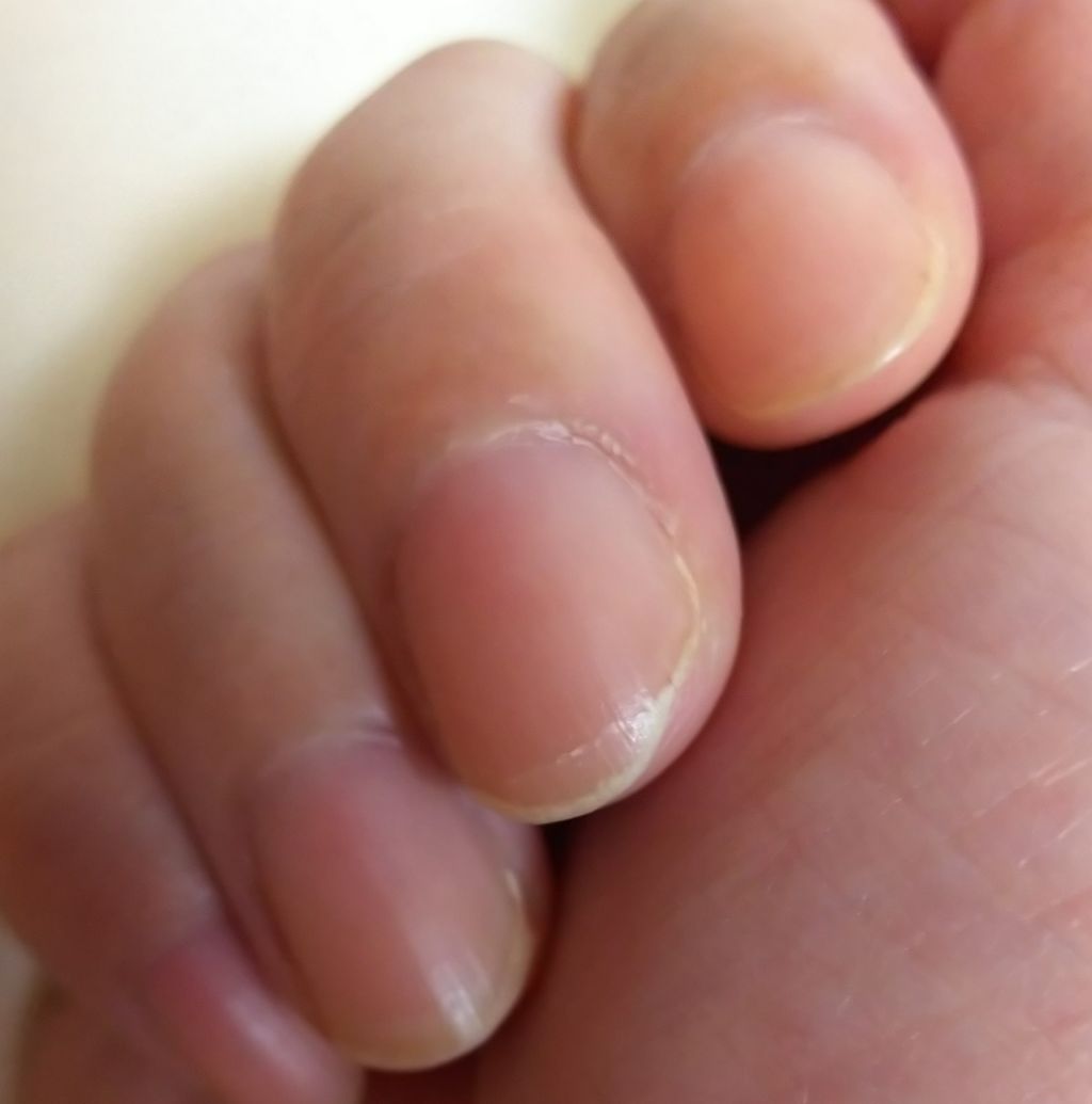 ネイルケアプロテクター/オルビス/ネイルオイル・トリートメントを使ったクチコミ（1枚目）