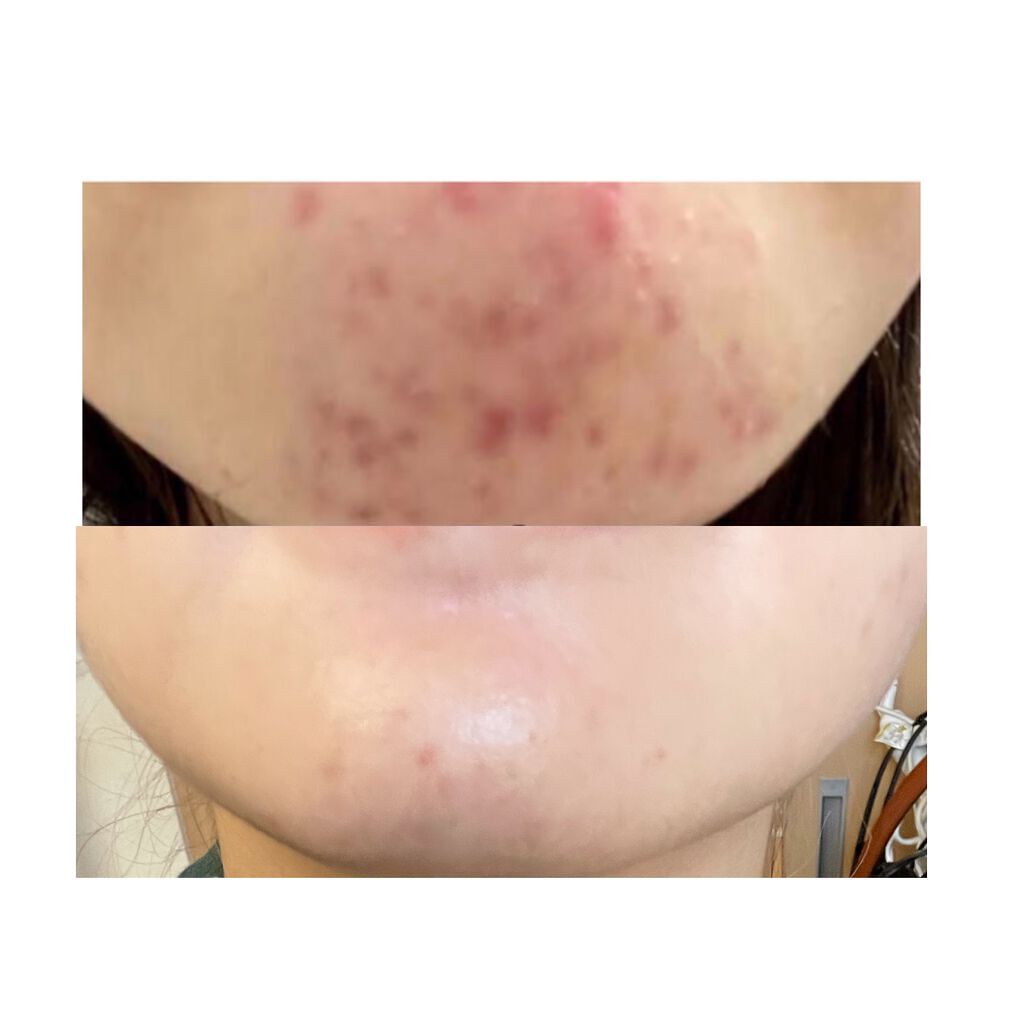 モイスチャライジングローション/エトヴォス/化粧水を使ったクチコミ(3枚目)