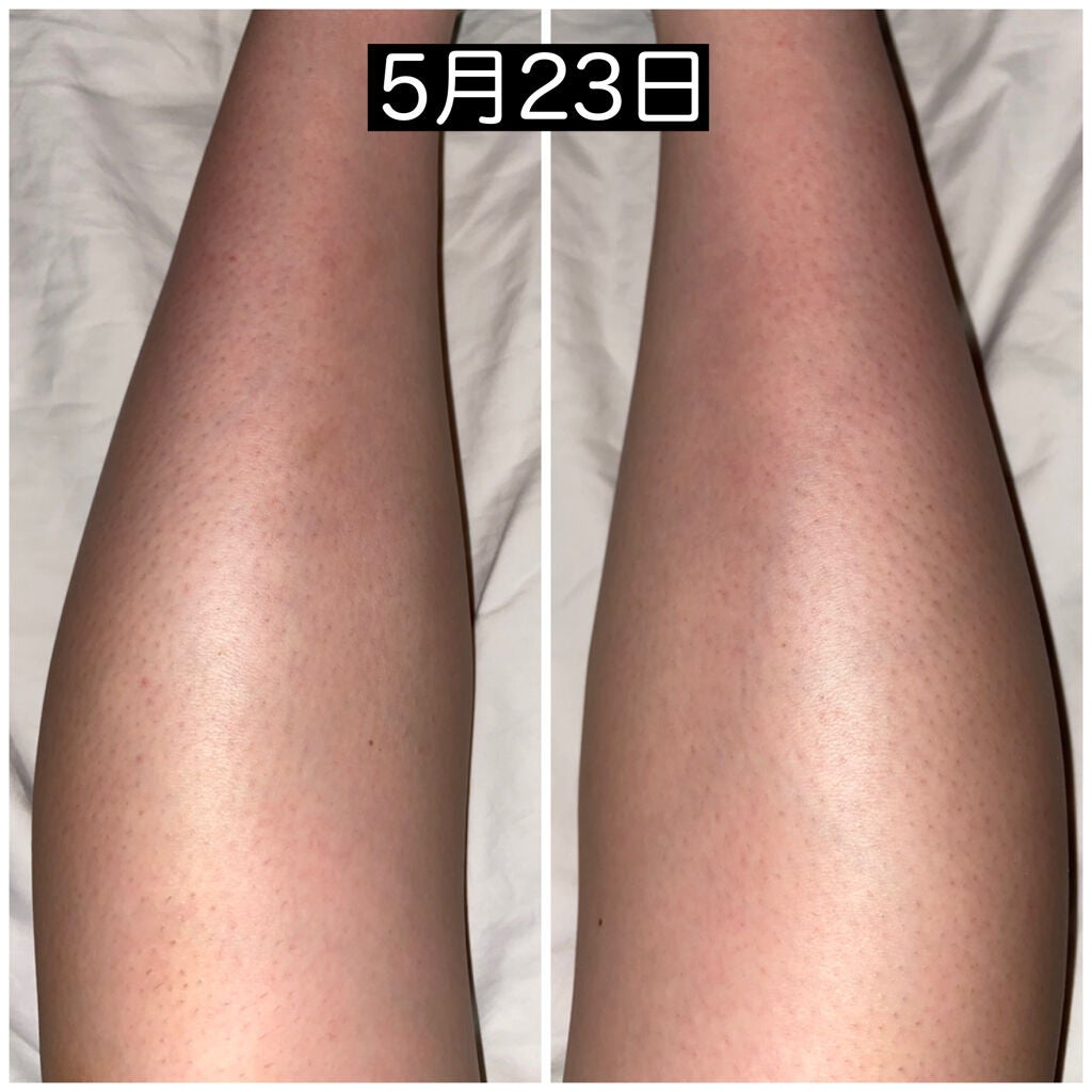 マイルド&モイスチャーアロエジェル/ネイチャーリパブリック/ボディローションを使ったクチコミ(2枚目)