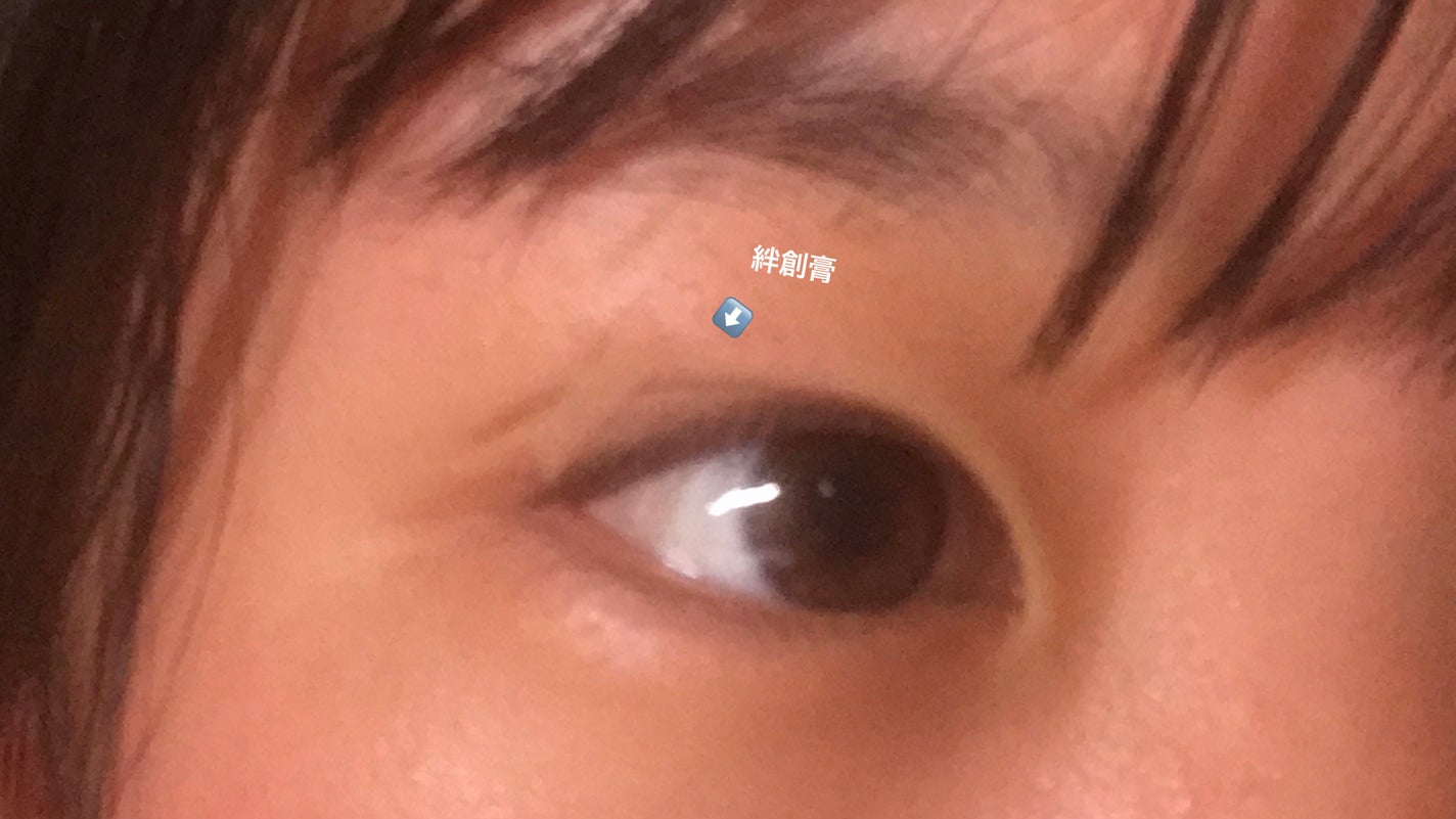 \\現役JC// on LIPS 「┈┈┈┈┈┈┈┈┈┈┈┈┈┈┈┈┈┈┈┈┈┈┈❕私が二重にした..」(4枚目)