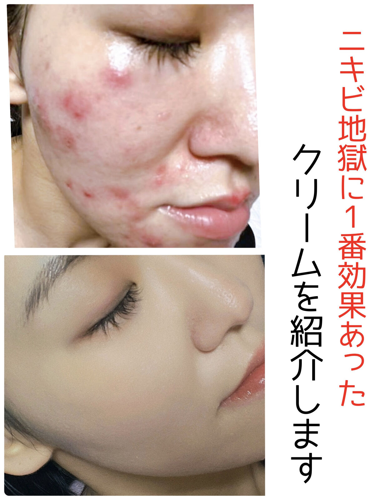 レチノールA 1% アドバンスドリバイタリゼーションクリーム/Life-flo/フェイスクリームを使ったクチコミ（1枚目）