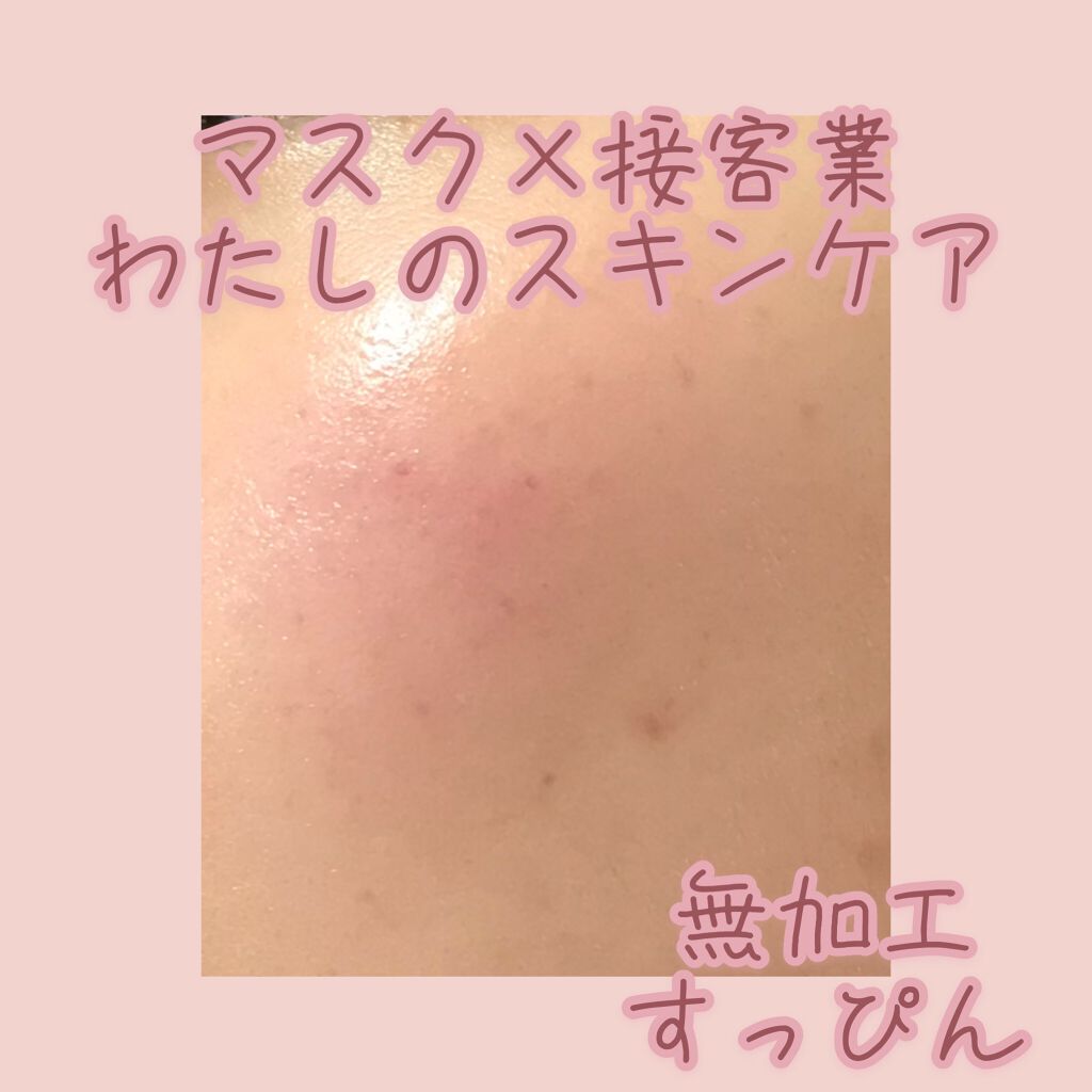 潤浸保湿 化粧水 III とてもしっとり/キュレル/化粧水を使ったクチコミ(1枚目)