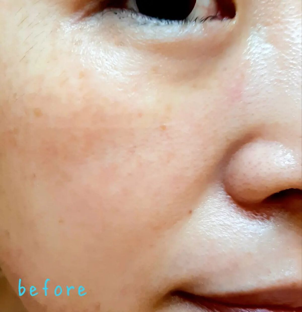 アカルミー化粧水/ワイズ/化粧水を使ったクチコミ(6枚目)