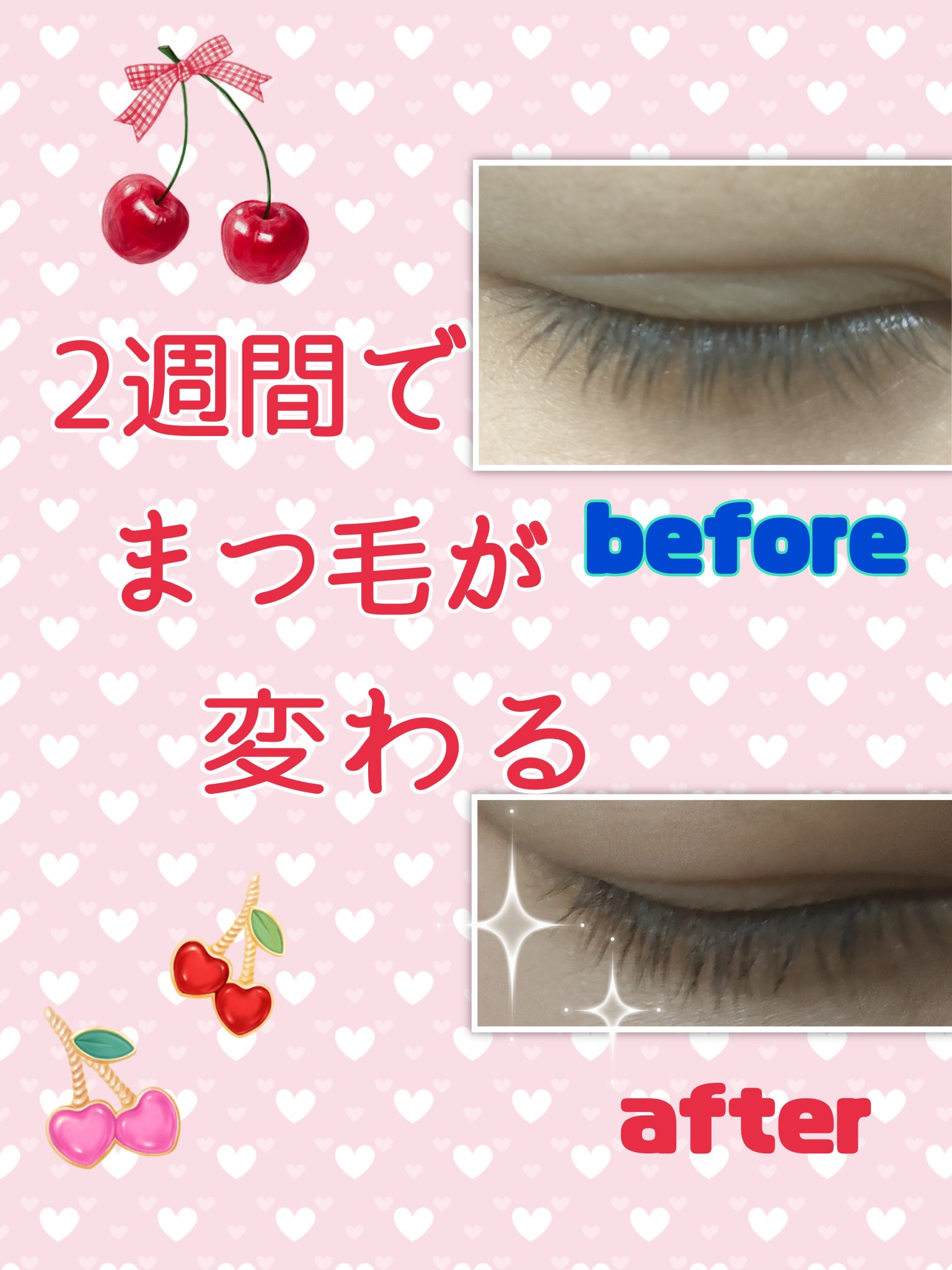 スカルプDボーテ ピュアフリーアイラッシュセラム プレミアムクイーン/アンファー(スカルプD)/まつげ美容液を使ったクチコミ（1枚目）