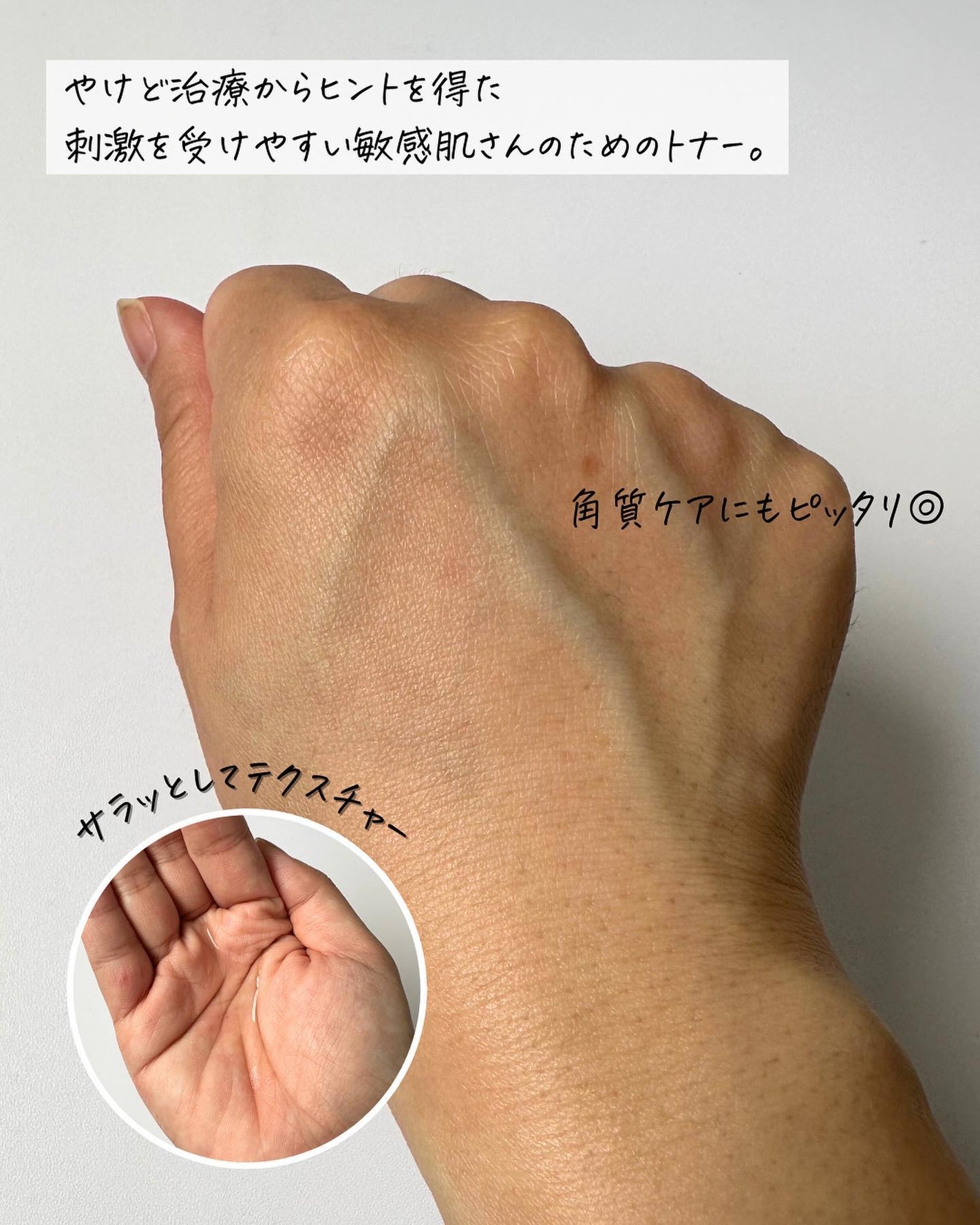 バリアサイクルトナー/P.CALM/化粧水を使ったクチコミ(3枚目)