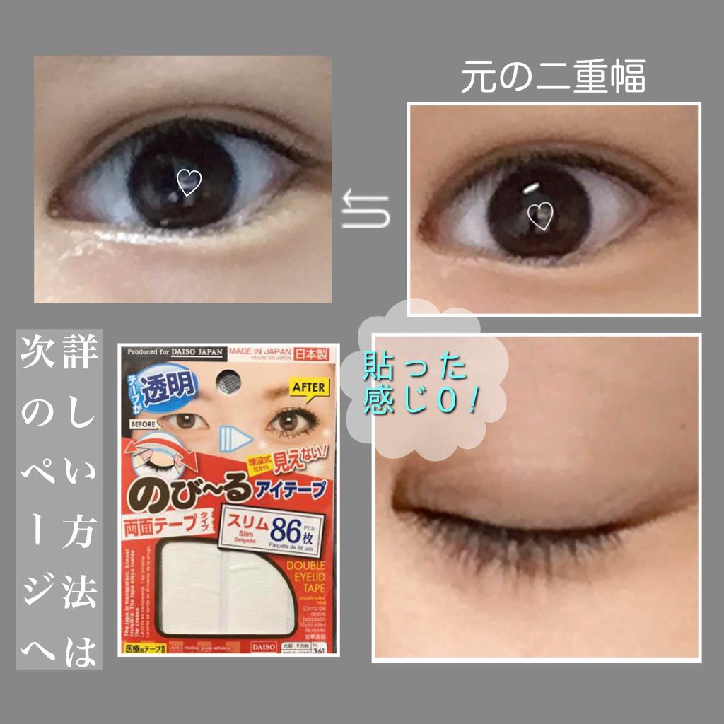 のび る アイテープ 絆創膏タイプ Daisoの口コミ 超優秀 100均で買えるおすすめ二重まぶた用アイテム 私流 二重幅を広げる By ℳ えむ 混合肌 10代前半 Lips