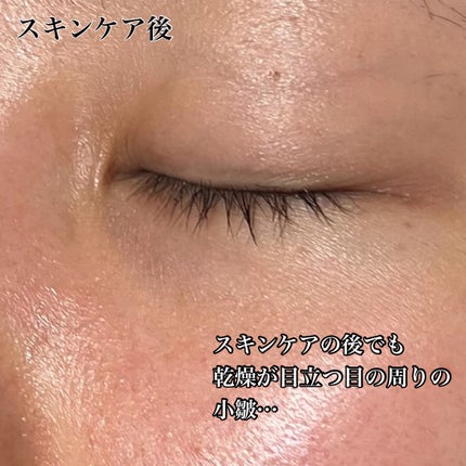 フィトコラーゲンアイセラムスティック/be wants/アイケア・アイクリームを使ったクチコミ(3枚目)