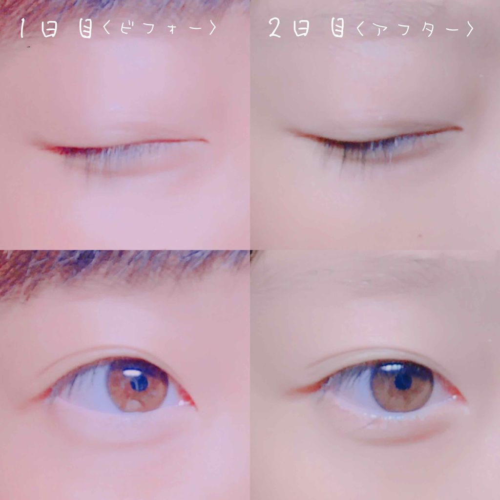 ローヤルゼリー配合 栄養ローション/DAISO/美容液を使ったクチコミ（1枚目）