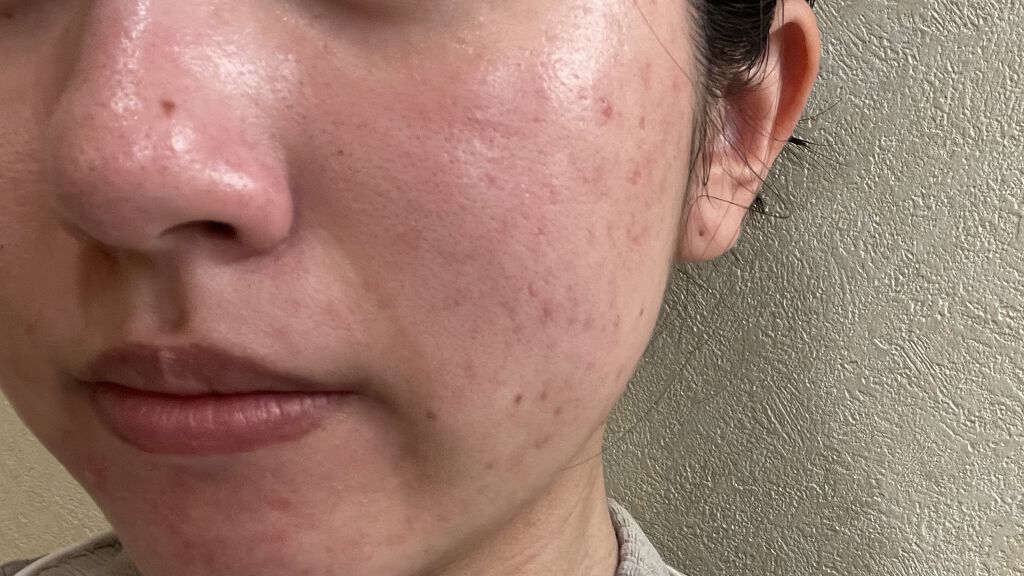 MT コントア セラム 30ml【旧】/MTメタトロン/美容液を使ったクチコミ（2枚目）