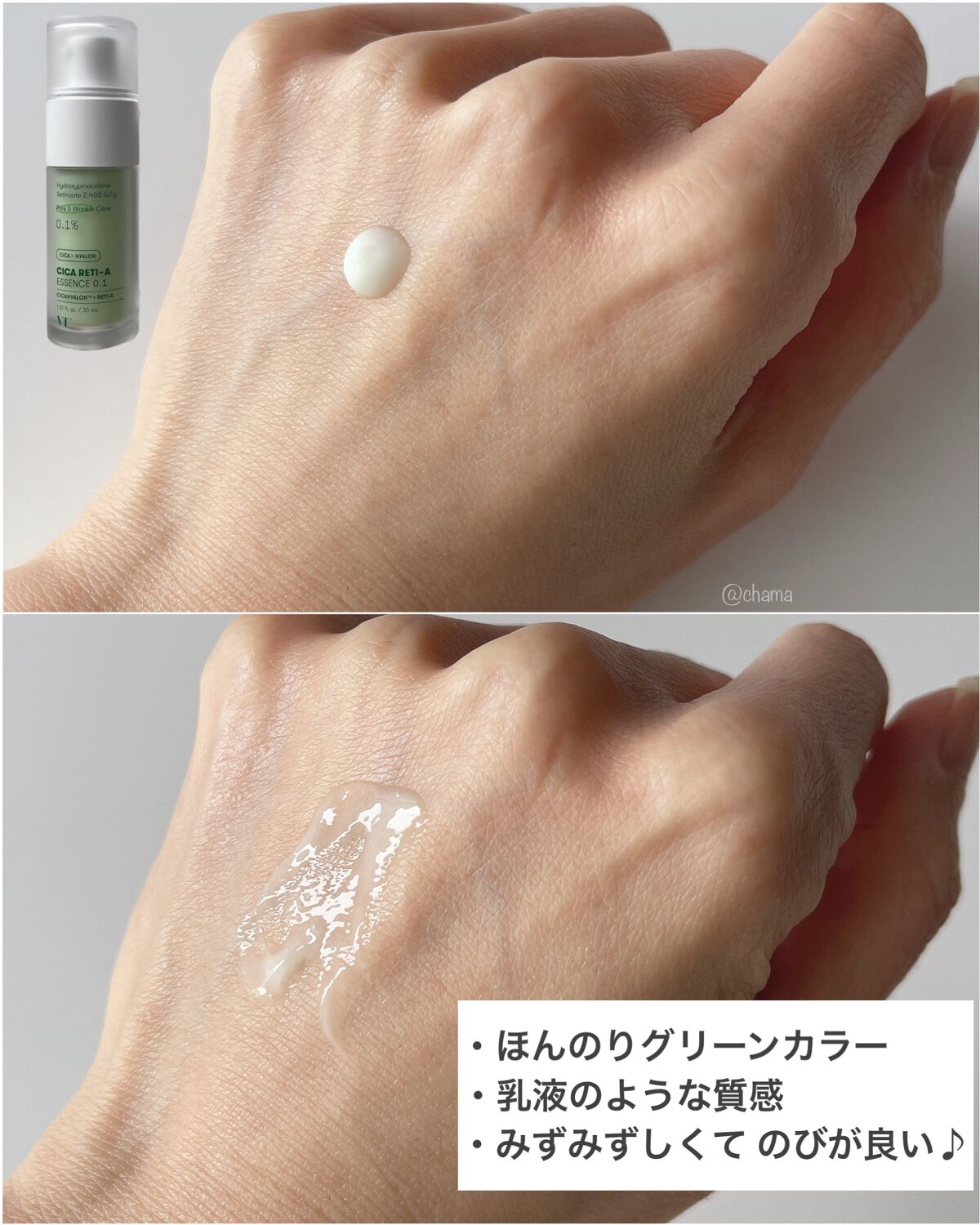 シカレチA エッセンス0.1/VT/美容液を使ったクチコミ(4枚目)