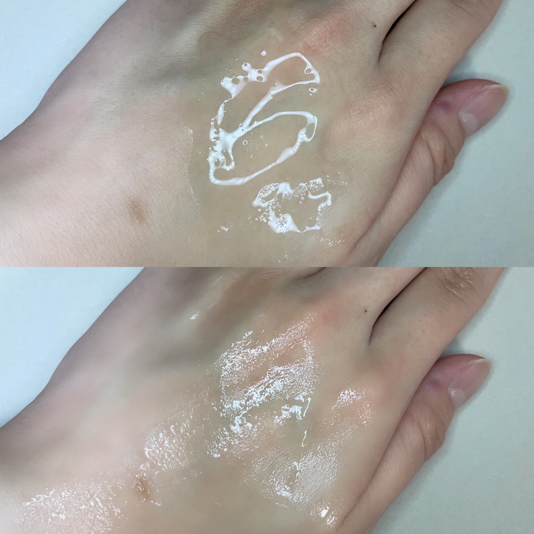 バイタルアクト ローション MB/d プログラム/化粧水を使ったクチコミ（3枚目）