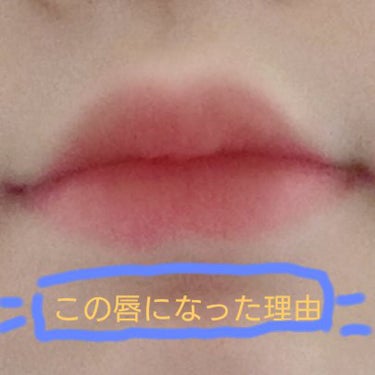 こーど on LIPS 「こんにちは！こーどです。今回は私の唇についてです。今日友達に唇..」（1枚目）