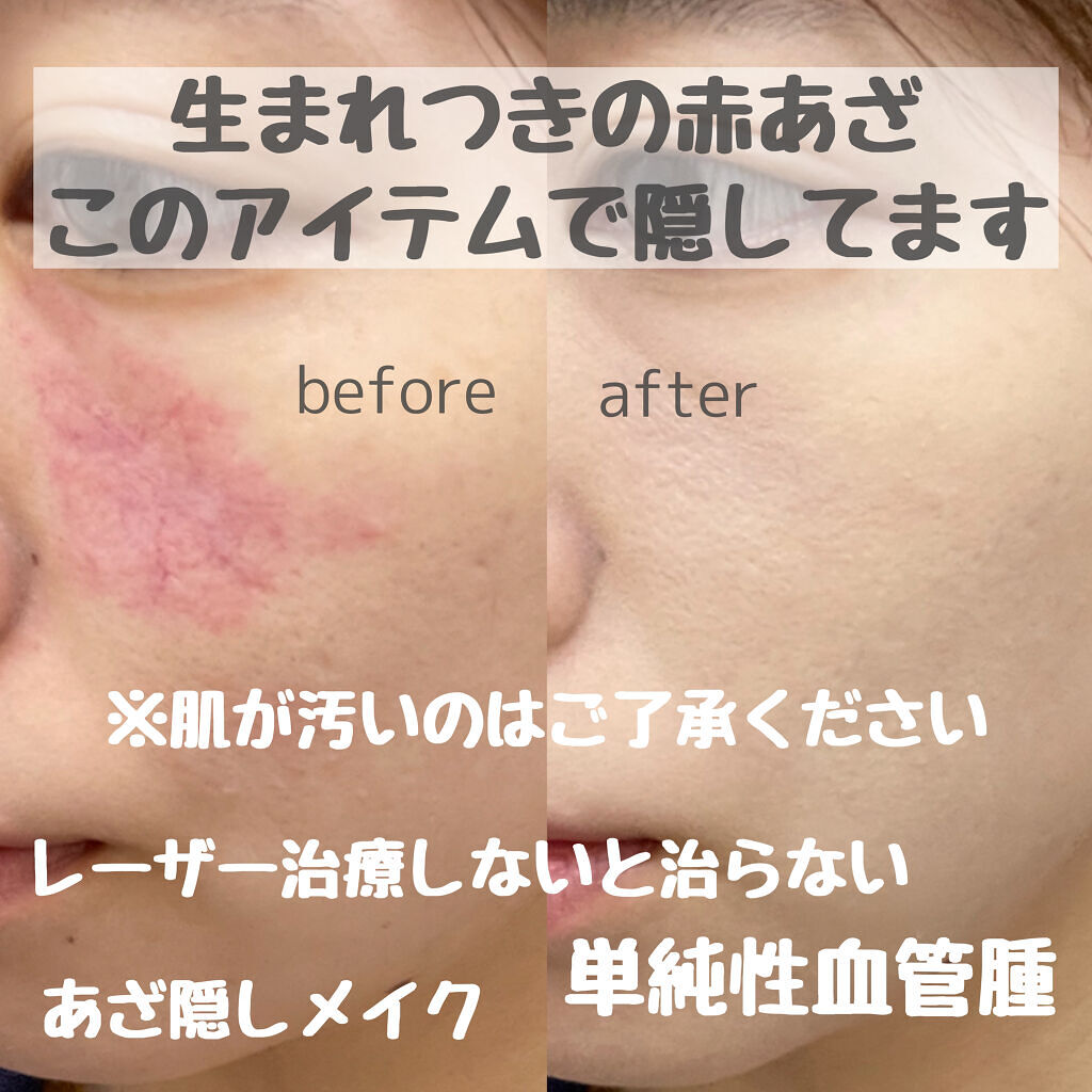 ファンデーション ＭＶ オークル10/パーフェクトカバー/クリーム・エマルジョンファンデーションを使ったクチコミ（1枚目）