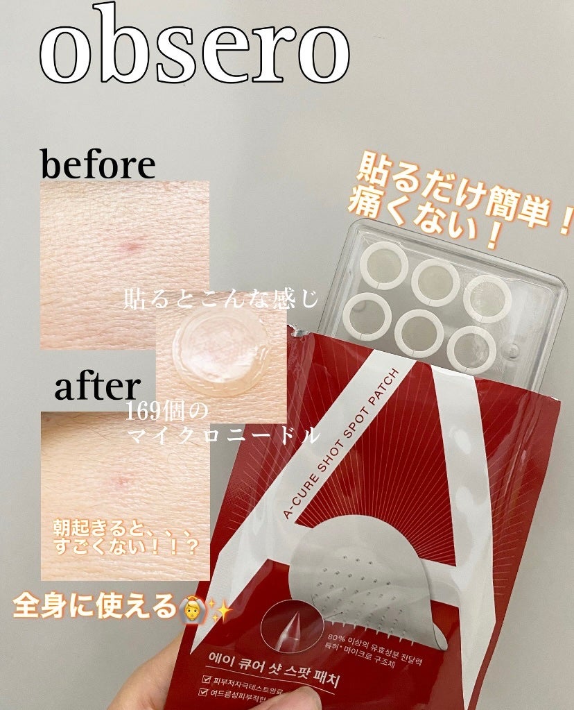 エーキュアショットスポットパッチ/obsero/にきびパッチを使ったクチコミ(1枚目)