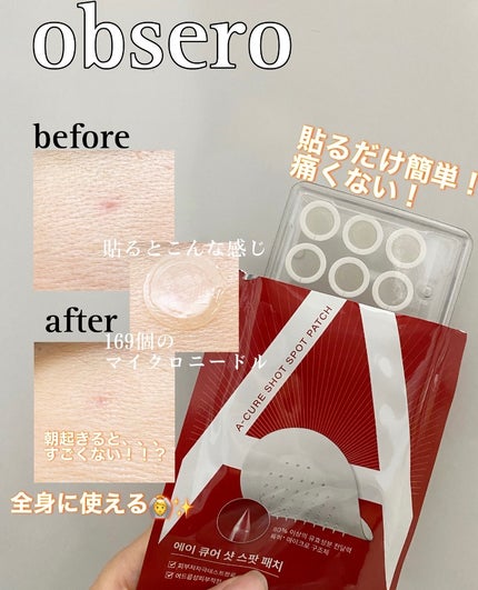 エーキュアショットスポットパッチ/obsero/にきびパッチを使ったクチコミ(1枚目)