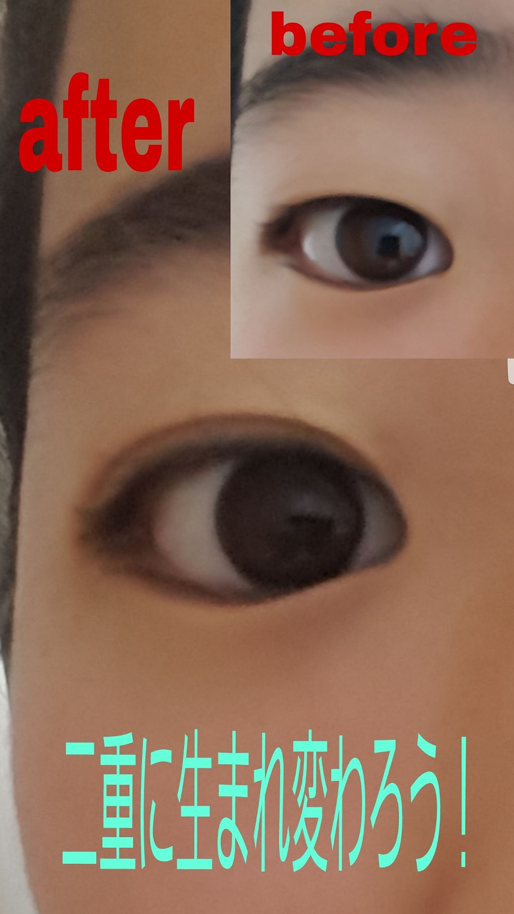 のび〜る アイテープ 両面テープタイプ/DAISO/二重まぶた用アイテムを使ったクチコミ（1枚目）