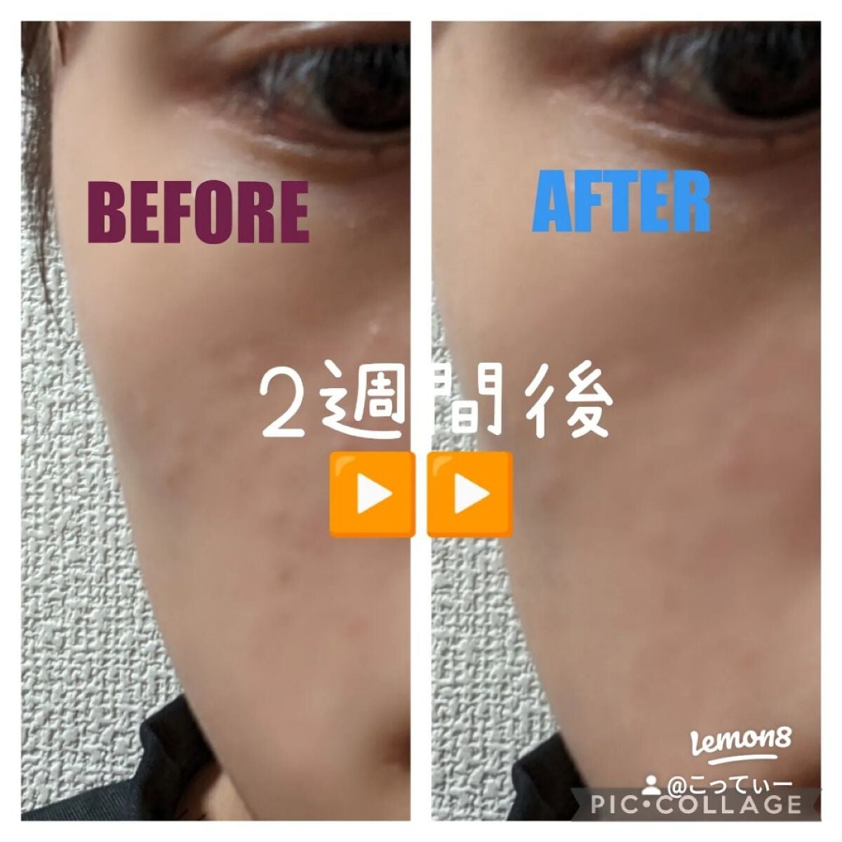 ティーツリーケア ソリューション エッセンシャルマスクEX/MEDIHEAL/シートマスク・パックを使ったクチコミ(2枚目)