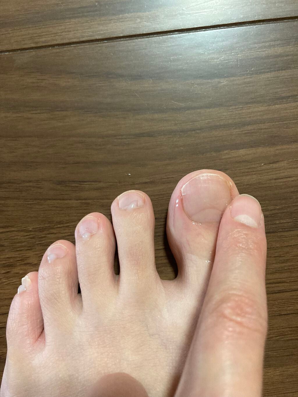 薬用 クリアストロングショット アルファ/北の快適工房/レッグ・フットケアを使ったクチコミ(4枚目)