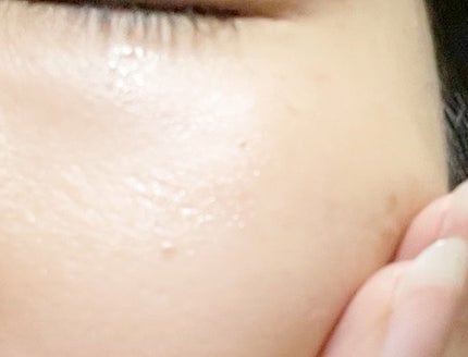 ユズナイアシンアンチブレミッシュセラム/SOME BY MI/美容液を使ったクチコミ(4枚目)