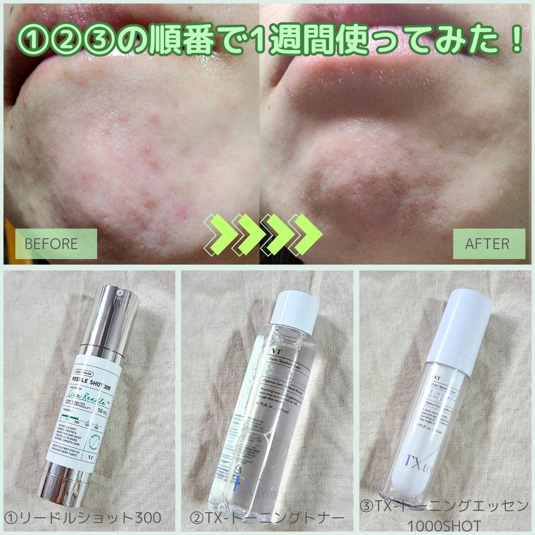 リードルショット300/VT/美容液を使ったクチコミ(2枚目)