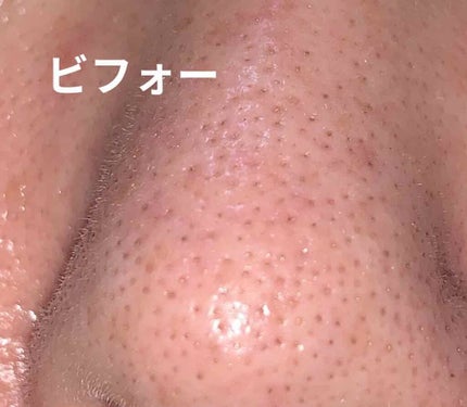 ディープクリア洗顔パウダー/ファンケル/洗顔パウダーを使ったクチコミ(2枚目)