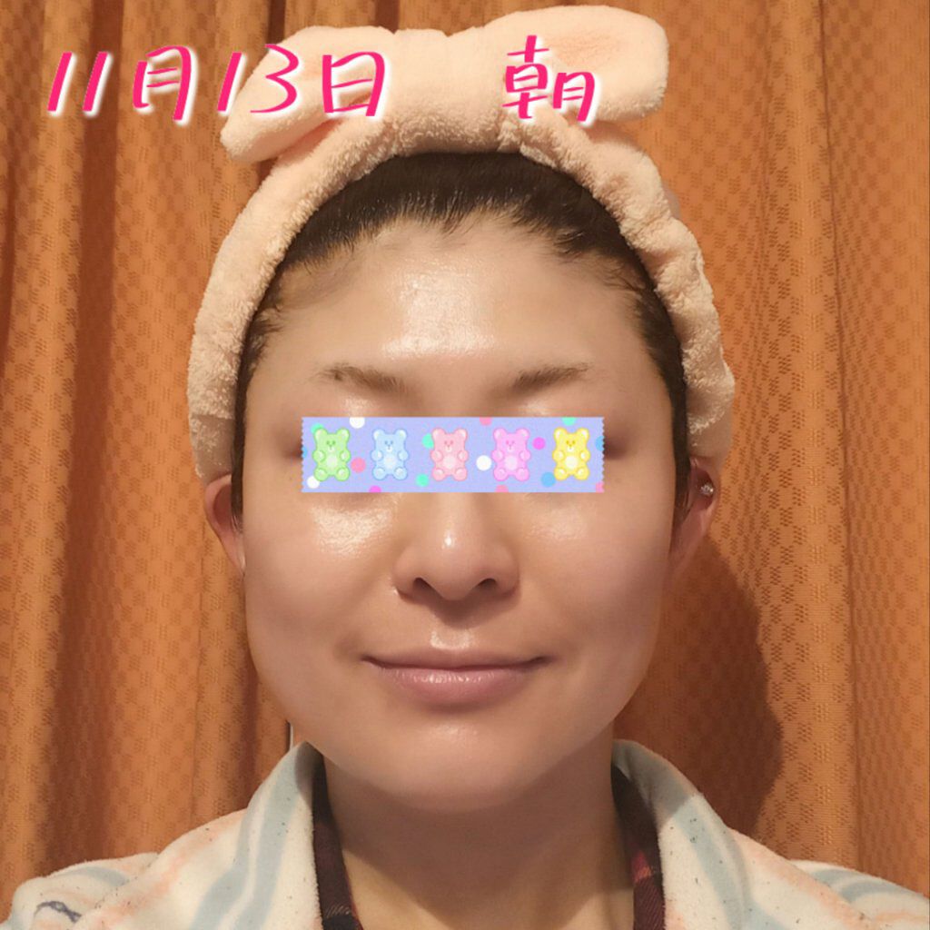 レチノールA 1% アドバンスドリバイタリゼーションクリーム/Life-flo/フェイスクリームを使ったクチコミ（1枚目）