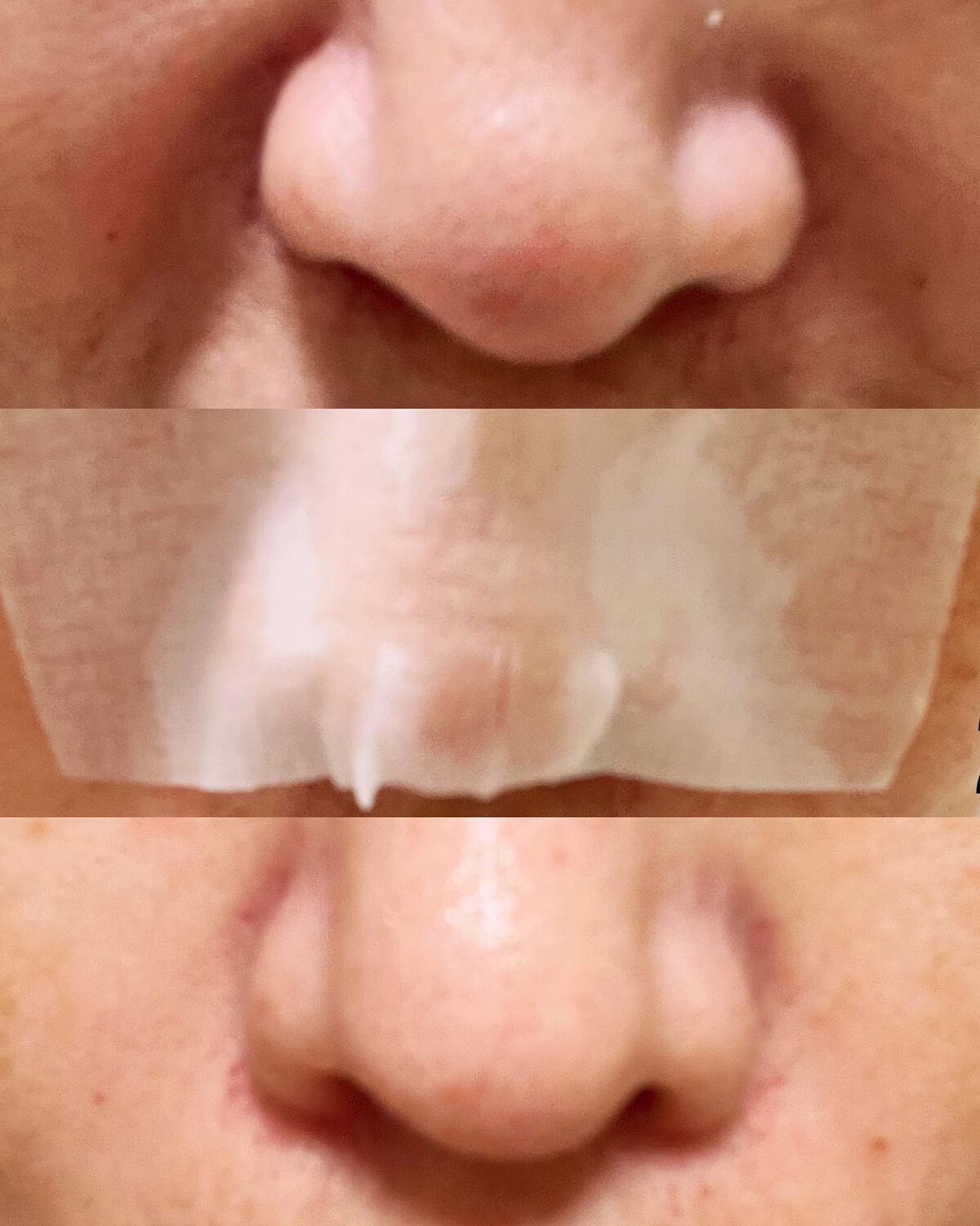 BHクリアノーズパック/CucuporeC/シートマスク・パックを使ったクチコミ(6枚目)