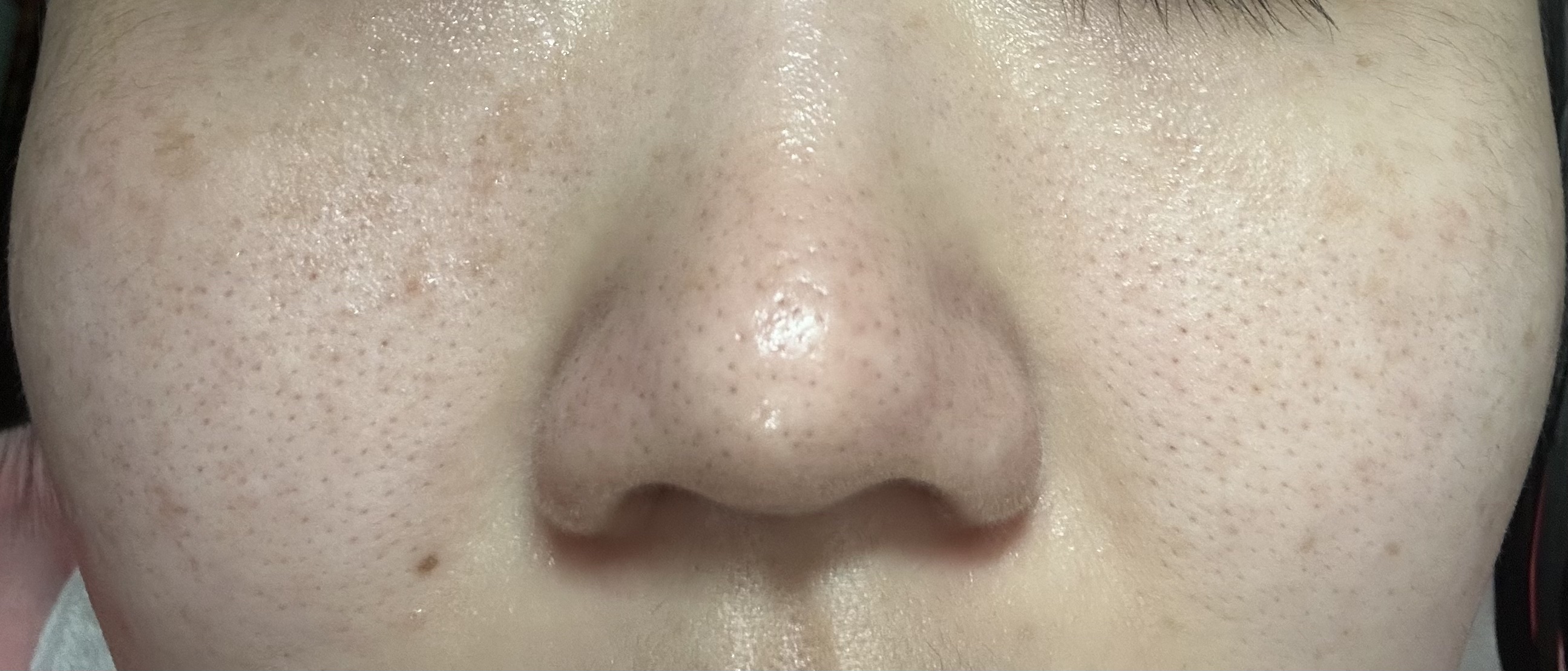 菊正宗 日本酒の化粧水 高保湿/菊正宗/化粧水を使ったクチコミ（3枚目）