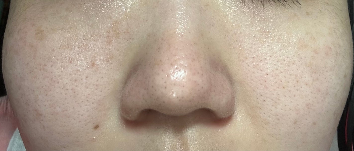 菊正宗 日本酒の化粧水 高保湿/菊正宗/化粧水を使ったクチコミ(3枚目)