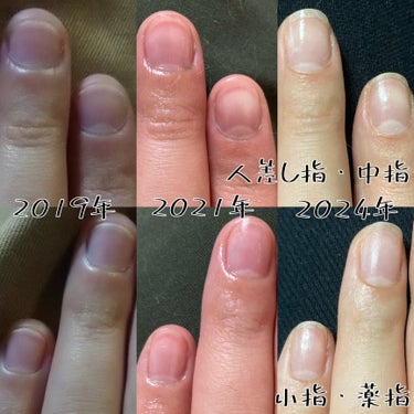 Pro nourishing nail oil/ohora/ネイルオイル・トリートメントを使ったクチコミ（2枚目）