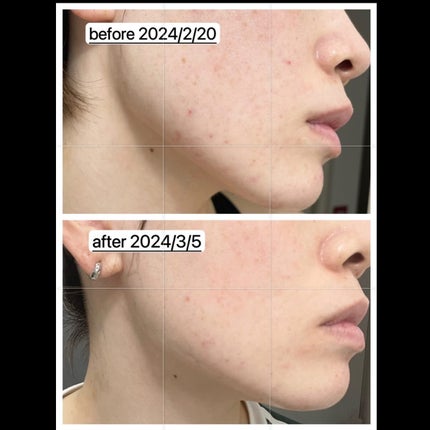 5番 白玉グルタチオンC美容液/numbuzin/美容液を使ったクチコミ(2枚目)