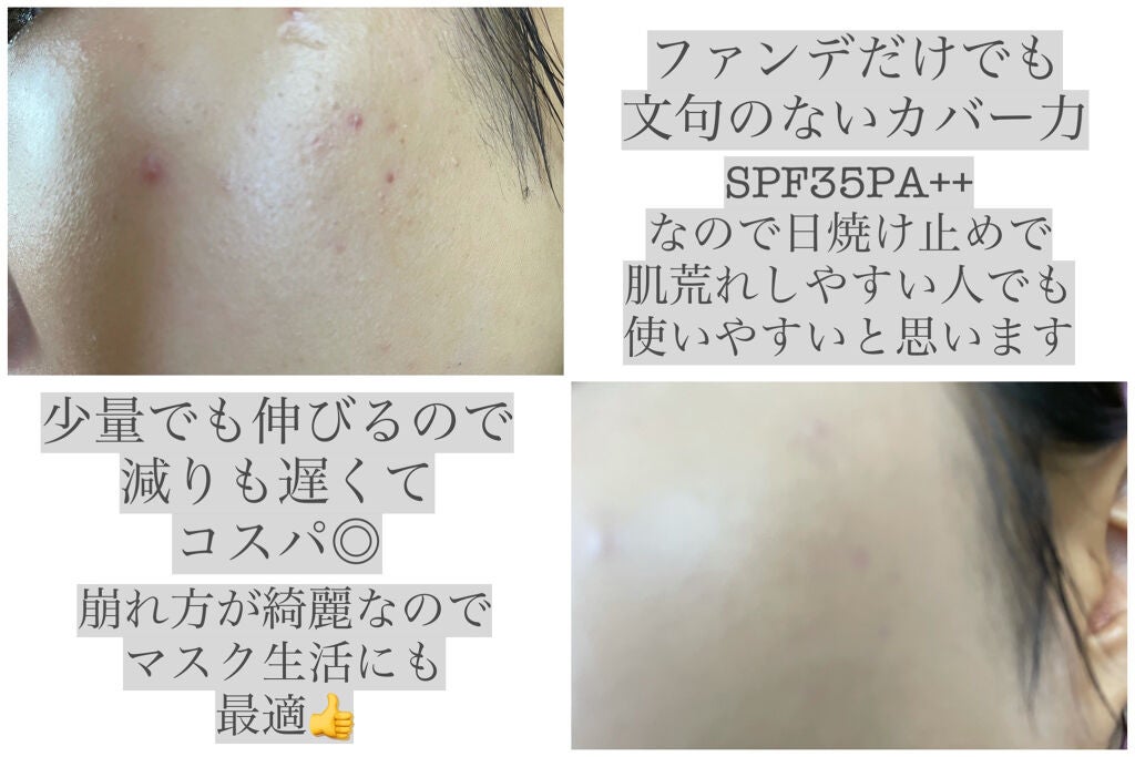 【旧】ディオールスキン フォーエヴァー フルイド グロウ/Dior/リキッドファンデーションを使ったクチコミ(2枚目)