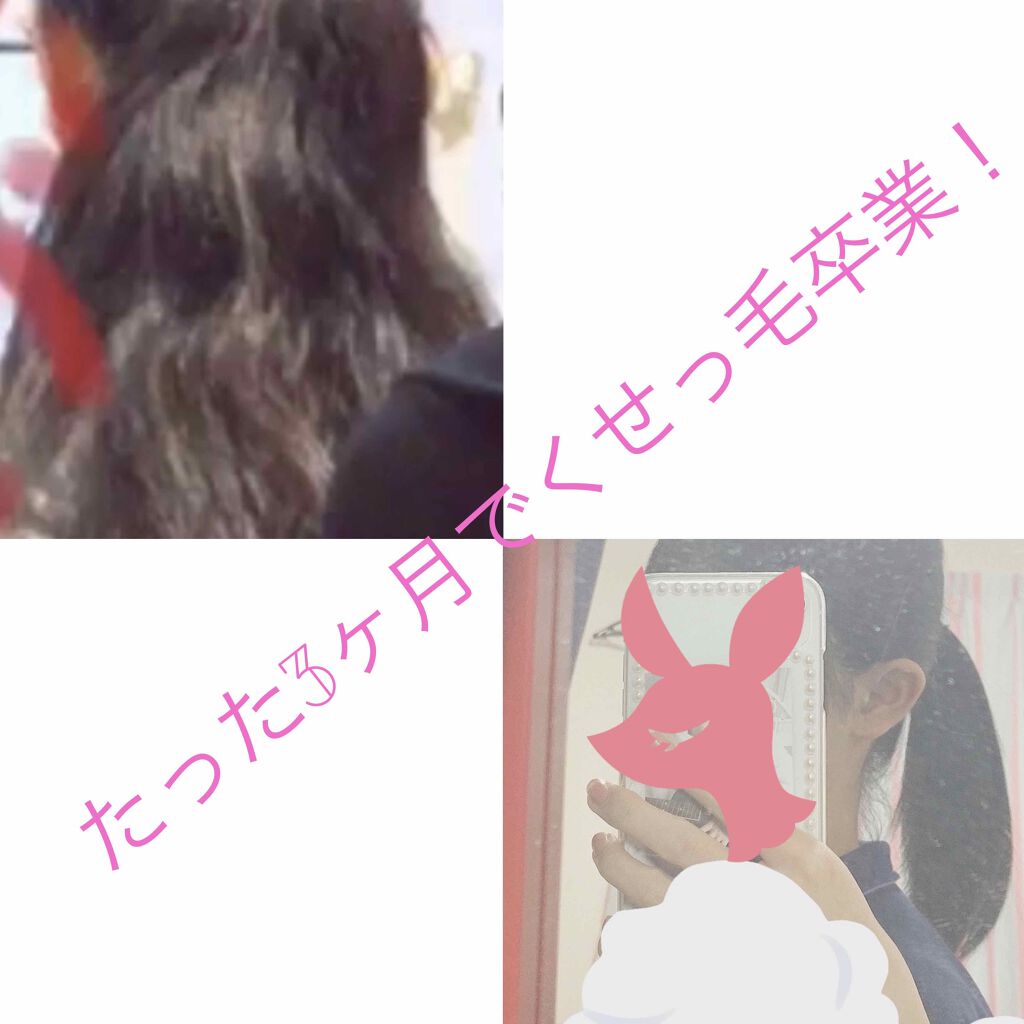 ジョンソンベビーオイル微香性/ジョンソンベビー/ボディオイルを使ったクチコミ（1枚目）