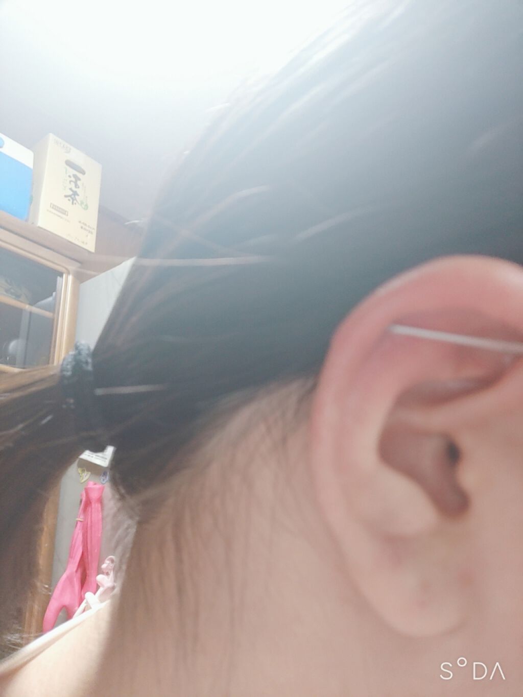 オロナインＨ軟膏 (医薬品)/オロナイン/その他を使ったクチコミ（2枚目）