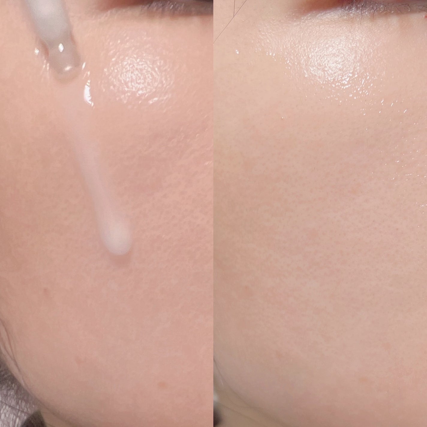 リアルナイアシンアミドセラム/NEOGEN/美容液を使ったクチコミ(5枚目)