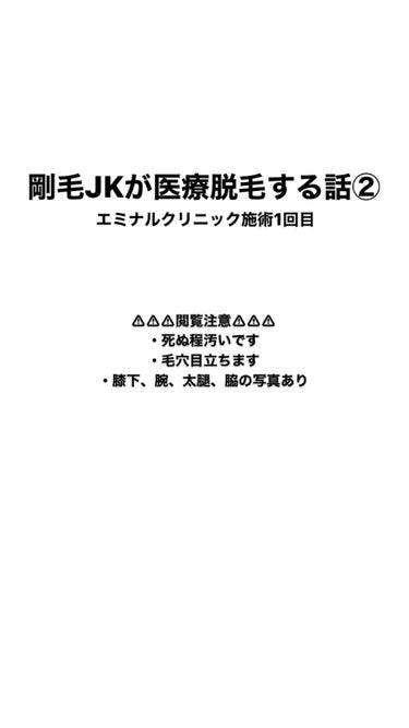 剛毛女 on LIPS 「医療脱毛1回目。閲覧注意。TikTokにも載せているので良かっ..」（1枚目）